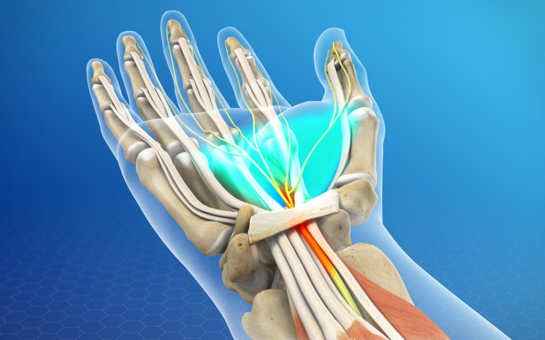 Periferik Sinir Cerrahisi